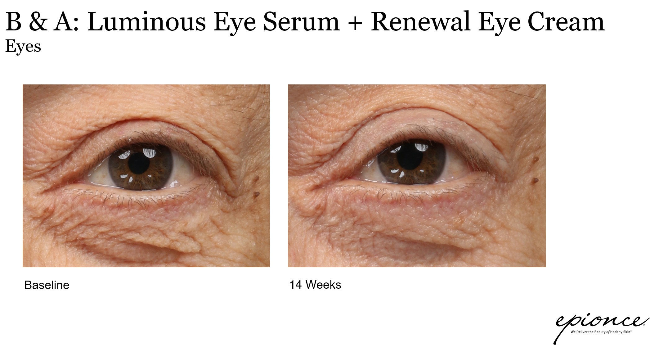 Luminous Eye Serum 15ml (CHF 88) abschwellendes Augenserum - Epionce