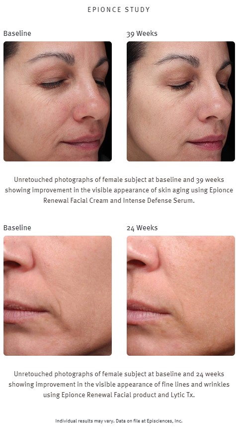 RENEWAL Facial Cream 50g Anti-Aging (CHF 110) - Epionce