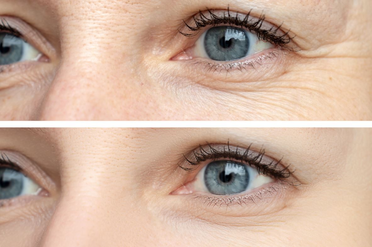 DELTA Eye Gel