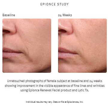 RENEWAL Facial Lotion 50ml Anti-Aging - Epionce