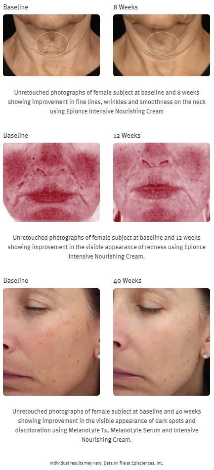 Intense Nourishing Cream 50g (CHF 110) - Epionce